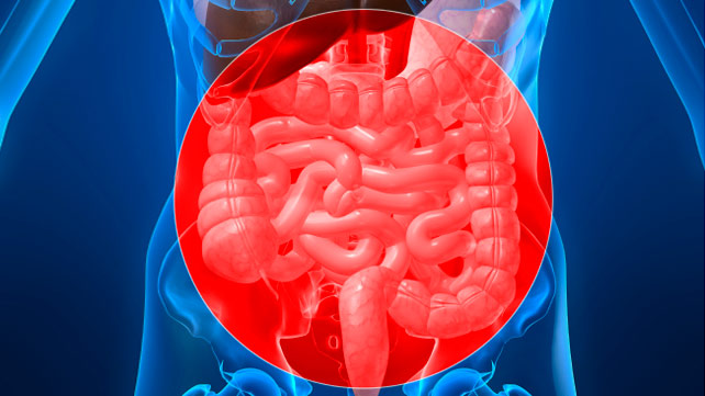 What is intestinal ischemia and its causes?